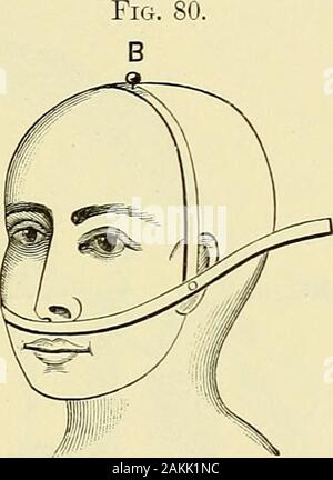 Un manuale per la moderna chirurgia : una esposizione delle dottrine accettato e approvato le procedure operative del tempo presente, per l'uso degli studenti e dei professionisti . Corpora Hypoph candicantia.Apertura canal è centralis. Colonna anteriore del cavo. Fissura c colonna posteriore di corda.Canalis centralis. Anatomia Topografica della superficie interna di emisfero destro.La localizzazione delle funzioni. (Ziehen.) localizzazione cerebrale. 205 i sintomi relativi a lesioni di un numero limitato di aree ancora requirefurther differenziazione, ma il valore di localizzazione cerebrale a surgicaltreatment ha così rapidamente aumentata Foto Stock