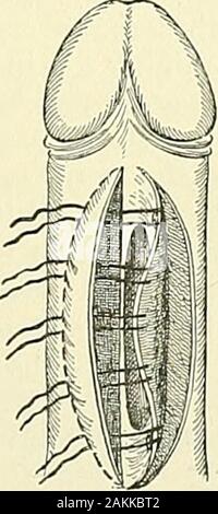 Un Americano di libro di testo dei genito-urinario malattie, sifilide e malattie della pelle . Foto Stock