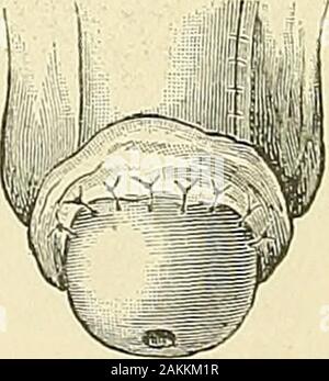 Un Americano di libro di testo dei genito-urinario malattie, sifilide e malattie della pelle . Foto Stock