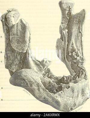 Traité d'anatomie topographique avec le applicazioni a la chirurgie . Du maxillaire supérieur. Le maxillaire supérieur présente avec les cavités de la faccia, lorbite, lesfosses nasales et la cavité buccale, des collegamenti sur lesquelles jai suffisam-mento insisté déjà. Il est creusé dans son épaisseur dune vasta cavité, sinusmaxillaire, dont jai signalé plus haut la forme, les rapports et les aptitudespathologiques, assez pour ny plus revenir. Il nous reste à esaminatore los en lui-même au point de vue de ses fratture etsurtout de sa résection. Le maxillaire supérieur, intimement uni avec celui du cô Foto Stock