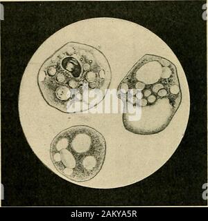 L'igiene delle malattie trasmissibili; il loro nesso di causalità, le modalità di diffusione e dei metodi di prevenzione . toplasmic corpo. Dimensioni varia da0,012 a 0,035 mm. di diametro. Kartulis è riuscito incultivating esso nel fieno di infusi e ha prodotto la dissenteria incats mediante iniezione di queste colture nel retto.^ si può notare che in sede di esame di feci di dys-enterica pazienti per le amebe ci sono alcuni punti che, ifobserved, faciliterà il loro rilevamento. Le amebe notuniformly sono presenti in tutte le parti del sgabelli. Essi sono la maggior parte del 1 Kartulis: Centralbl. fur Bakteriolog Foto Stock