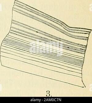 Lehrbuch der klinischen Untersuchungs-Methoden : für Studirende und praktische Aerzte . %. Fig. 155. Ecliinococcusbestandtheile: 1. Freie Scolices, " ausgestülpt, b eingezogen; 2. Häekchen:3. Membran (vergrösserter Querschnitt) nach Heller. Foto Stock