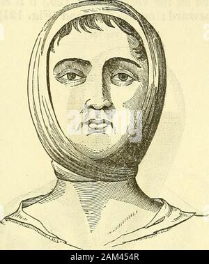 Nuovi elementi di intervento chirurgico . Medicazione provvisoria per le fratture. 193 Usare viene poi sollevato, direttamente verso l'alto, oppure obliquamente back-Ward, e trasportato verso il vertice della testa, dove è veloce-ulteriormente rafforzata da un nodo o con l'ausilio di perni. (Fig. 119.). Articolo IV.-bendaggi per il collo. Le medicazioni ordinario per il collo sono realizzati da un collo mano-fazzoletto, {moucfioir en cravate ;))))) questa è stata la prassi per agea (Fig. 120.) Foto Stock