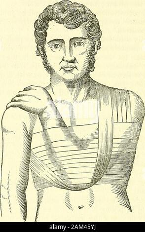 Nuovi elementi di chirurgia operativa . antagoista rispetto a quella di sostenere il gomito andforearm e di lea.ving la guarigione della lesione per natura. II. Bendaggio dell'autore, (Fig. 117.) non vi è alcun dubbio dal fatto cheuna semplice sciarpa è molto più prezioso che le bende e diff^er-ent decantate macchine di ritardo. Essa provoca infinitamente meno fatica, whileit realizza appieno come regolare di un'unione. Ma io ho escogitato abandage, per mezzo di una semplice fascia, che è adattata sia tosterno-clavicular luxations, per il quale ho avuto in un primo momento progettato, andalso a acromio-clavicular lussazioni e fratture della clavicola, acro Foto Stock