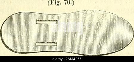 Nuovi elementi di intervento chirurgico . 134 NUOVI ELEMENTI DI CHIRURGIA OPERATIVA. lunghezza sufficiente per essere prolungato nella forma di un fissatore a vicino al gomito sul lato della prua-braccio. Il semelie è un'altra piastra(Fig. 70) perforato con morticedopenings in prossimità dei suoi bordi, e sagomato,jiijj||I||lipir può essere detto, alla pianta del piede,^?^^ che essa è destinata a sostenere orprotect in alcuni casi. Articolo VI.-nastri (Lacs) e stringhe, {cordoni) alcune medicazioni richiedono l'impiego di corde. Questi generallyconsist di ribands, e pezzi {des combattimento) del bendaggio o stringhe.nastri (Les Lacs) di riband Foto Stock