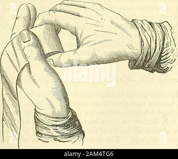 Nuovi elementi di chirurgia operativa . grado di destrezza, se egli non desidera essere eccelso da thenurses. A tal fine stiamo per ripiegare le estremità interna orcentral testa del bendaggio a quattro o cinque volte su se stesso, che itmay formano una sorta di asse. Dobbiamo quindi tenere questo nucleo del cylin-der tra il pollice e avanti o dito medio del diritto handby le due estremità del suo diametro più grande. Il Loose partedell il bendaggio, gettati attraverso il lato radiale della fore-fingerof la mano sinistra, è mantenuta piatta in quella posizione mediante il pollice di thathand, mentre l'altra mano, disegno Foto Stock