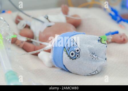 Neonato con supporto ventilatorio e accesso venoso, in reparto di terapia intensiva, presso l'ospedale di Chidren. Guayaquil. Ecuador Foto Stock