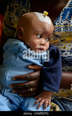 Rwanda, Butare, Health center Gikonko, madre con figli che sono stati infettati da idrocefalo e che hanno funzionato qui / RUANDA, Butare, Institut Saint Boniface, Krankenstation Gikonko, Mutter mit ihrem Kind, das mit der Krankheit Hydrozephalus operiert wurde, Frau Albertine und ihrem Kind Ella Foto Stock