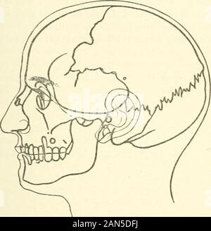 Manuale di pazzia per professionisti e studenti . Fig. 8.-(dopo Merkel.) meno, ma la sua ampiezza è più sviluppata. La base del cranio thefemale è più stretto e più corto. La maggior parte strik-ing peculiarità del cranio femminile, come si vede nella livingsubject nel profilo, è la linea di curvatura superiore; le variazioni nel cranio. 139 appiattimento della regione parietale passa abbastanza improvvisamente sullato un lato in verticale linea frontale, sull'altro sideinto la linea inclinata dell'occipite, in modo che più o meno un-golare curve si sviluppano su entrambi i lati. Nel maschio il cranio. Fig. 9.-(dopo Merkel.) Questo Foto Stock