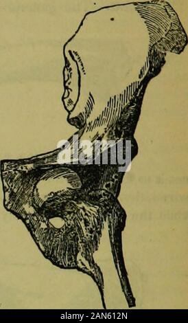 L'enciclopedia idropatici: un sistema di idropatia e igiene .. . Verso il basso LUrATIOW Fig. 23". • Ictwup LtriAno" Foto Stock