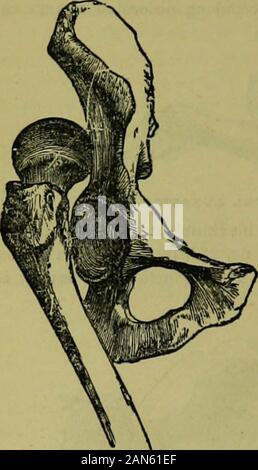 L'enciclopedia idropatici: un sistema di idropatia e igiene .. . 393 3URGEKY l'ileo, figura 236, )r verso il basso, in il foramen ovale, fig. 237. oi Fig. S3G. Fig. S37.. CPWAUD LUXATE f. Fig. 238. Foto Stock