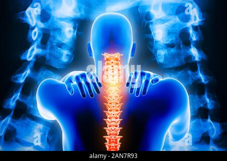 Uomo del corpo con la colonna vertebrale e x-ray vertebre immagini in background. Dolore al collo o cervicalgia, backbone o lesioni cervicali 3d rendering illustratio Foto Stock