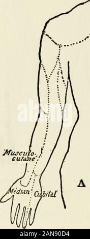 I principali sintomi di isteria : quindici lezioni nella scuola di medicina dell'Università di Harvard [tra il quindicesimo giorno del mese di ottobre e la fine di novembre, 1906] . Fig. 0.- -Schema di varie forme di local-virtualizzato hysteric anestesia. 156 i principali sintomi di isteria di cosce e sulla loro faccia interna, ma riguarda il anusand genitali. Su questa distribuzione di insensi-bilities e sui luoghi delle regioni riservata isfounded la diagnosi anatomica delle lesioni di thenerves e dei tumori del midollo. Ma è. Foto Stock