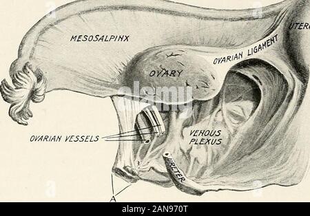 Ginecologia per studenti e professionisti . owerand frontiere interne. Il bordo superiore è gratuita e contiene il fallo-pian tubo tra le sue pieghe per quanto riguarda l'ostio addominale, che isintra-peritoneale. Da questo punto la parete pelvica il borderis superiore libera e si distingue come infundihulo-piega pelvico. Il ovarianvessels eseguito nella parte superiore di un terzo di questa piega. Il bordo esterno è 26 ginecologia attaccato al pelvico laterale parete lungo una linea che si estende obliquamente dal recinto vasi iliaci esterni verso il basso e in avanti e verso l'interno per thepelvic piano. Il bordo interno è fissato ai lati Foto Stock