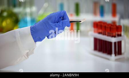 I campioni di sangue e provette con liquido colorato in piedi sulla tavola del laboratorio Foto Stock