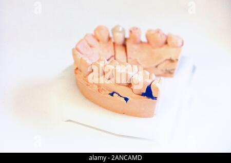 Getta della ganascia. Formazione presso il dentista. Denti anatomici stampe. Istruzione per l'ortodontista. Foto Stock