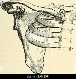 Una pratica Treatise on fratture e lussazioni . lete dai traumi. [Duckett,1 di Manchester, segnala un caso di ante-sternale whichoccurred dislocazione durante il nuoto.] sintomi.-la testa dell'osso, a meno che la persona è exceedinglyfat, o grande rigonfiamento sono sopraggiunte, può essere distintamente sentito e visto di fronte lo sterno ; la corrispondente spalla scende un po' indietro ; la testa si inclina talvolta anche per lo stesso lato; i movimenti di armare in imbarazzo e accompagnato quasi sempre con un acuto painat il punto di lussazione. La porzione clavicular del sternocleido-mas Foto Stock
