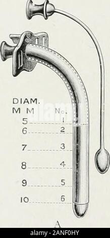 Endoscopia perorale e chirurgia laringea . sphyxia del paziente. Questi tubi sono realizzati da autori ilie scala(Fig. 440). H questi tubi si trovano troppo lunga, le probabilità sono i tra-cheotomy h;è stato fatto troppo alta. Stenosi Ior Deep down al di là di thepoint dove un tr;icheotomy wmnid può scendere al di sotto di esso, la lunga canna sagomata 590 TRACHEOTO?.lY. caiinulae mostrato A, Fig. 439 devono essere utilizzati. Con tlie aiuto di thebronchoscope per determinare la condizione, nessun paziente deve morire per wantof aria come lungo come egli ha il tessuto polmonare per lo utilizzano. Questi lunghi può-nulae può in alcuni casi richiedono ofif taglio a t Foto Stock