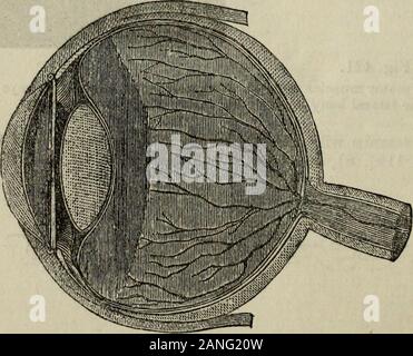 Di idropatia pratico, compresi i piani di terme e di commento sulla dieta, abbigliamento e abitudini di vita.. . RiOTOK muscoli e ghiandola lacrimale di otto occhi.- Sappey. Sezione verticale dell'occhio sinistro.-Siippeif l'orecchio. 425 Foto Stock