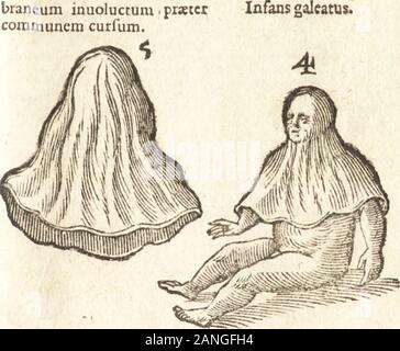 De naturae diuinis characterismis, seu, Raris & admirandis spectaculis, causis, indiciis, proprietatibus rerum in partibus singulis vniuersi, libri II . Galea infantum fiue mem-brancum inuoluctum piastcrcommunem curfum.. * 3 $6 COSMOCRIT. IIB. I. EFFLVXIONVM VITALIVM* & non fpecies vitalium 3. 1. Il Generis. Secundigeneris varia. Foto Stock