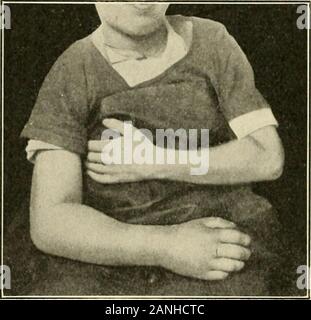 Un libro di testo di primo soccorso e di un trattamento di emergenza . nt per ricordare che molti di più i germi sono ^emo^edby l'uso di acqua e sapone che da disinfettanti da soli.in modo che in un trattamento di emergenza è molto meglio washthe mani bene rispetto al loro immersione in soluzioni antisettiche. La riparazione di ferite. La guarigione di ferite e le misure necessarie toproduce il rendimento normale di funzione sono più in theprovince del chirurgo che in quella del secouriste, SI) WOiXDiS AXD WOL.MJ JFL:cTU)X ma la cni(.riren(.y tiratiiicnt è hotttr uiulorstood se laprima-aiuto workt-r lias una chiara c()iicoi)tioii Foto Stock