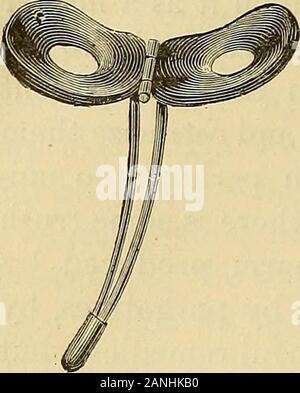 Note cliniche sulla chirurgia uterina : con particolare riferimento alla gestione della condizione sterile . 264 chirurgia uterina.. Fig. 108. Foto Stock