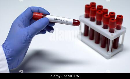 Beta hCG test, medico che mostra il campione di sangue nel tubo, laboratorio di ricerca, salute checkup Foto Stock