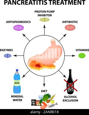Trattamento di pancreatite. La struttura dello stomaco e del pancreas. Infographics. Illustrazione Vettoriale su sfondo isolato. Illustrazione Vettoriale
