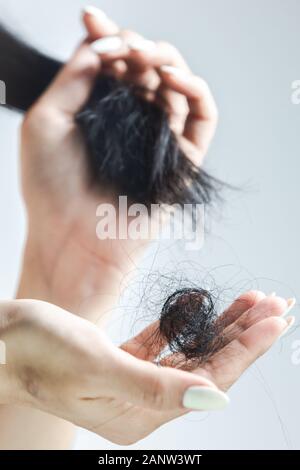 Donna capelli cadere / perdita di capelli problema. Foto Stock