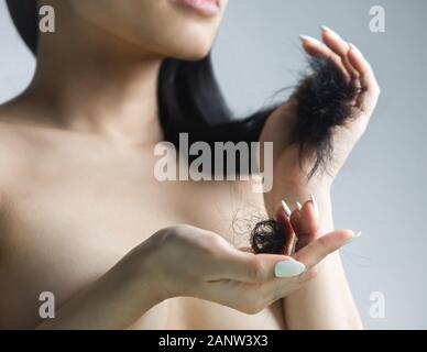 Donna capelli cadere / perdita di capelli problema. Foto Stock