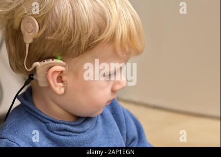 Un ragazzo con gli apparecchi acustici e impianti cocleari Foto Stock