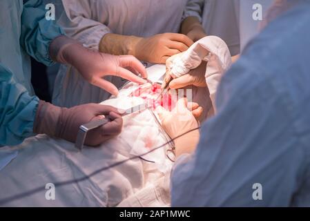 I medici - bambini chirurghi, in uno sterile in sala operatoria, eseguire un funzionamento dei reni. Al chirurgo la mani strumenti chirurgici, manipolare Foto Stock