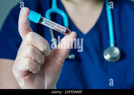Infermiere che ha ottenuto un risultato positivo per il nuovo Coronavirus, che si sta diffondendo rapidamente, originario di Wuhan, Cina Foto Stock