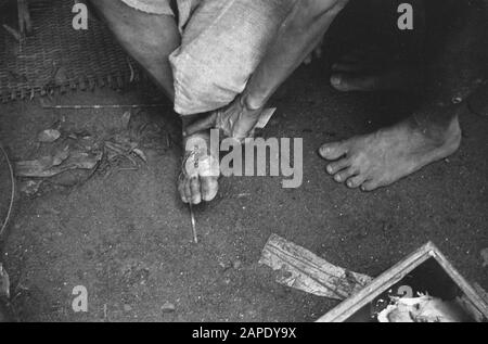 Croce rossa a Medan Descrizione: Arnhemia: La popolazione - forzata evacuata dal TNI per la liberazione della città e finalmente liberata dalle truppe olandesi - ritornata in una condizione più che miserabile nella loro città natale. Qui furono accolti dalla Croce Rossa Olandese e ricevettero rifugio, abbigliamento, cibo e, soprattutto, cure mediche urgenti. Medici e infermieri specializzati aiutano le centinaia di pazienti: Lambosia, malaria, edema, berrie-berrie. Data: 8 Ottobre 1947 Località: Arnhemia, Indonesia, Indie Orientali Olandesi, Sumatra Foto Stock