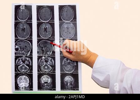 L'immagine di risonanza magnetica o MRI del cervello maschio e della mano del medico Foto Stock
