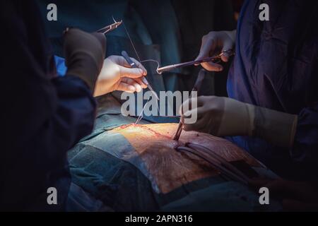 Il team medico di chirurghi in ospedale facendo minimamente invasivo di interventi chirurgici. La chirurgia sala operatoria con apparecchiature di elettrocauterizzazione per cardiovas Foto Stock