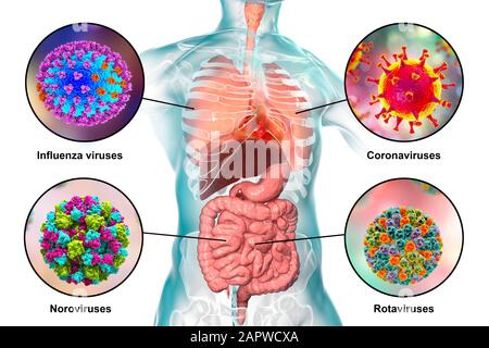 Infezioni virali respiratorie ed enteriche, illustrazione Foto Stock