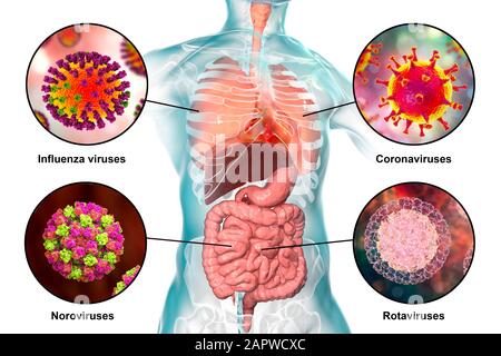 Infezioni virali respiratorie ed enteriche, illustrazione Foto Stock