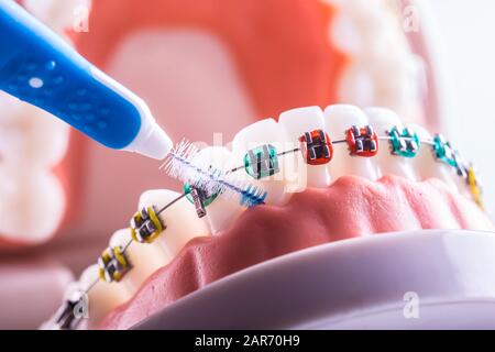 Modello di dente da denti dentari con spazzola per pulizia denti interdentali Foto Stock