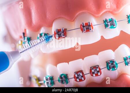 Modello di dente da denti dentari con spazzola per pulizia denti interdentali Foto Stock