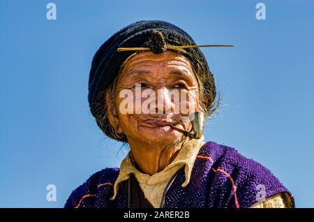 Ritratto di un vecchio Apatani indossando il tradizionale acconciatura con la maglia alla fronte, fumo tubo Foto Stock
