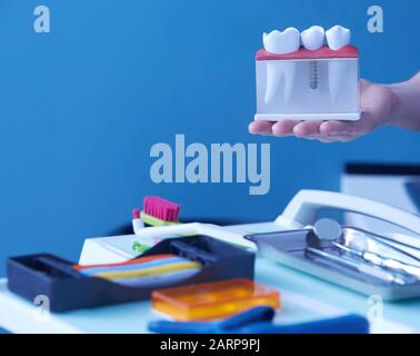 Le mani del dentista tenere una breadboard modello del dente con un impianto Foto Stock