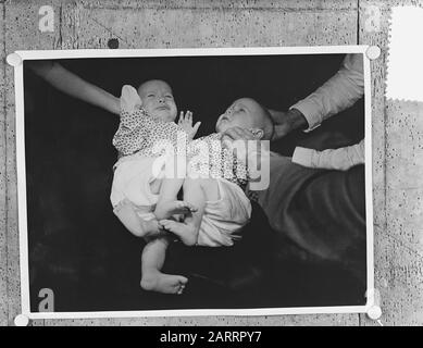 Siamese twins Leeuwarden, left Folkje, right Tjitsk Data: 13 giugno 1954 luogo: Friesland, Leeuwarden Parole Chiave: Twins Nome personale: Folkje, Vries, Tjitske de Foto Stock