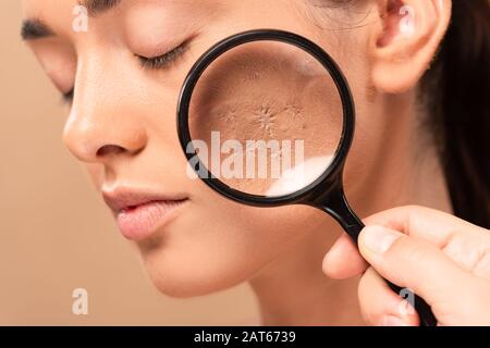 vista dal taglio corto della lente d'ingrandimento da uomo vicino alla giovane donna con la pelle problematica isolata su beige Foto Stock