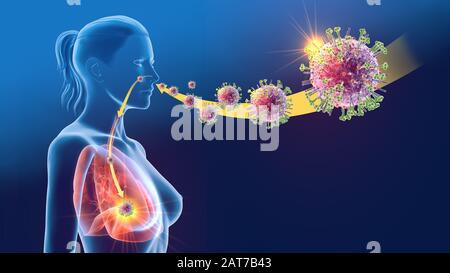 Illustrazione 3D che mostra i virus influenzali infettanti una donna Foto Stock