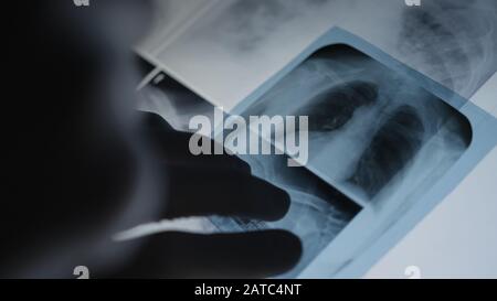 Medico che esamina la pellicola radiologica toracica del paziente in ospedale. Concetto Medico. Foto Stock