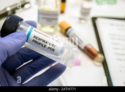 Lo scienziato esamina il campione di coronavirus in laboratorio, immagine concettuale Foto Stock