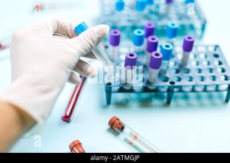 Medico con guanto medico che maneggia un flaconcino con campioni medici nel laboratorio di analisi Foto Stock