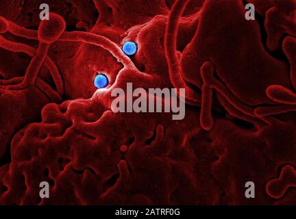 Immagine al microscopio elettronico a scansione con colorazione digitale e fortemente ingrandita (SEM), che mostra dettagli ultrastrutturali sul sito di interazione di due particelle virali di coronavirus (MERS-cov) di forma sferica, di sindrome respiratoria del Medio Oriente, blu colorizzato, che erano sulla superficie di una cellula epiteliale di cammello, rosso colorizzato, 2014. Mers è nella stessa famiglia del romanzo coronavirus che ha iniziato a infettare i pazienti a Wuhan, in Cina all'inizio del 2020. Courtesy National Institute of Allergy and Infectious Diseases (NIAID)/CDC. Immagine prodotta nel 2014. () Foto Stock