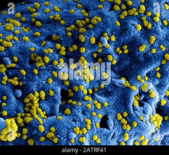 Immagine al microscopio elettronico a scansione (SEM) con colorazione digitale, altamente ingrandita, che mostra dettagli ultrastrutturali nel sito di interazione di numerose particelle virali di coronavirus (MERS-cov) di colore giallo, della sindrome respiratoria del Medio Oriente, situate sulla superficie di una cellula vero E6, che era stata colorata in blu, 2014. Mers è nella stessa famiglia del romanzo coronavirus che ha iniziato a infettare i pazienti a Wuhan, in Cina all'inizio del 2020. Courtesy National Institute of Allergy and Infectious Diseases (NIAID)/CDC. Immagine prodotta nel 2014. () Foto Stock